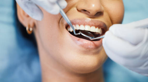 Best Affordable Emergency Dental Care  in Lake Shastina, CA